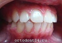 ����� �������