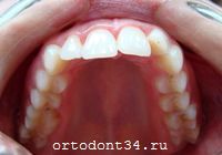 �� �������