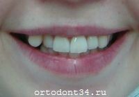 �� �������