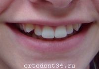 �� �������
