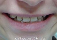�� �������