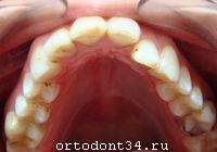 �� �������