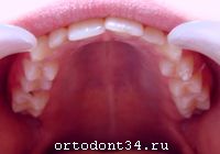 �� �������